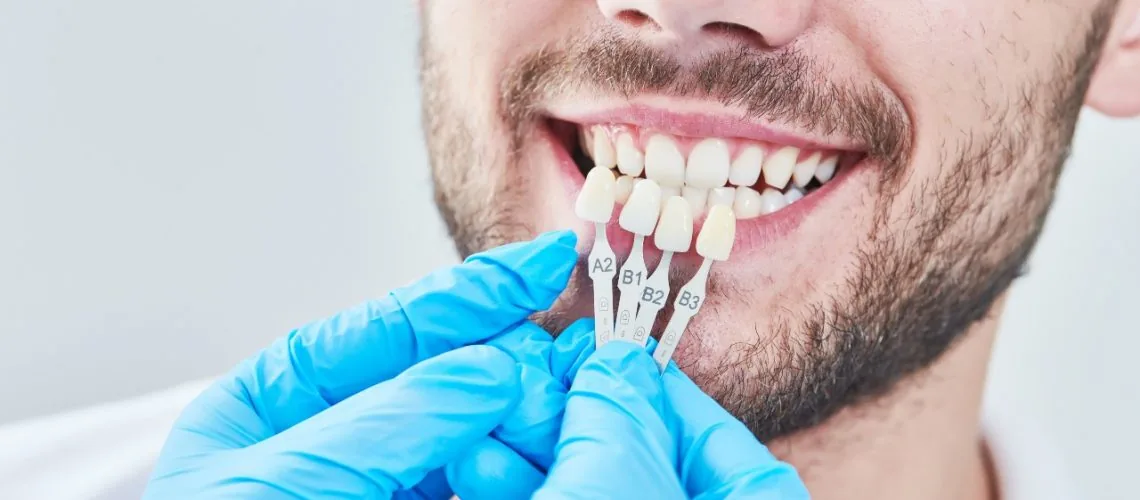 How Long Do Veneers Last — Wicker Park Dental Studio, Chicago
