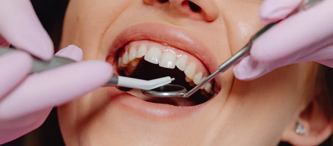 How to Get Rid of Swollen Gums — Wicker Park Dental Studio, Chicago